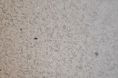 Détection de phase dorée-500 fois la phase dorée